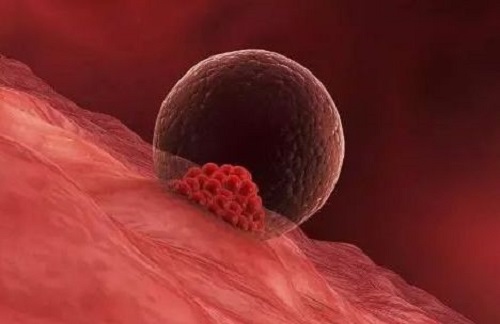 为什么有的人试管婴儿怀孕后会流产？