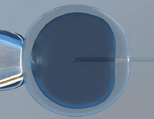 上海市第一妇婴保健院试管婴儿医院好吗？成功率高吗？