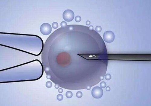 第三代试管婴儿真的可以自由筛选？