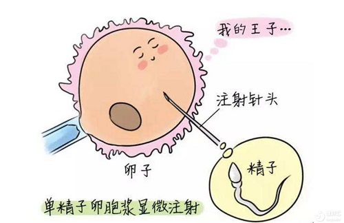 试管婴儿的全部流程费用