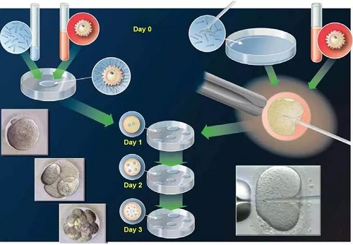 赴泰试管婴儿,怎么才能选择成功率高的医院?