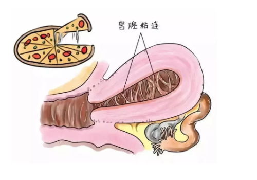 怎么去泰国做试管需要什么条件？​