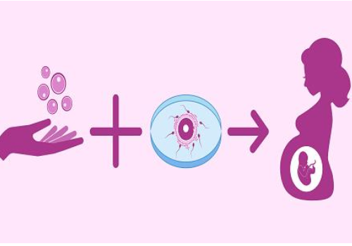 在美国做试管婴儿大概费用？