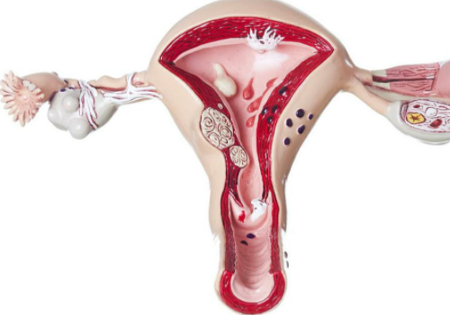 泰国试管婴儿准备哪些?