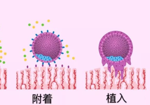 俄罗斯试管成功的？