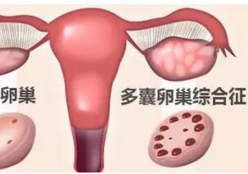 俄罗斯试管哪个医院好流程有什么？​